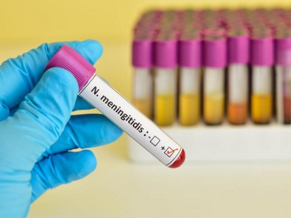 Meningite, attivato servizio di consulenza allo Spallanzani