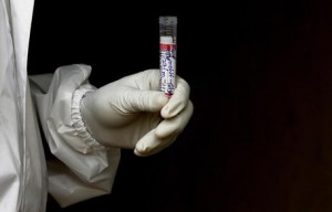 Coronavirus: oltre 25 milioni i contagi nel mondo. Il bilancio dei decessi sale a 842.992