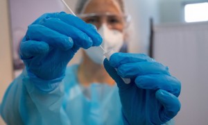 Coronavirus in Italia 80.653 contagi e 157 morti: bollettino 21 luglio
