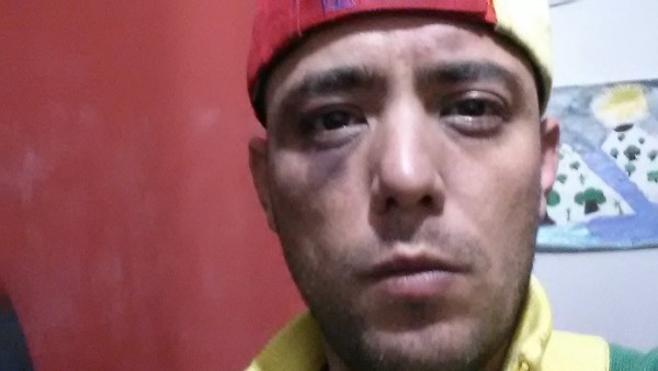 Il giornalista venezuelano Jesús Medina riappare vivo dopo tre giorni picchiato e torturato