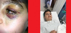 Pulsano (Taranto) - Il ragazzino è stato circondato dal branco e picchiato ed è ora in ospedale