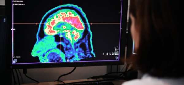 Le ricerche del Cern sul cervello che fondono neuroscienze e intelligenza artificiale