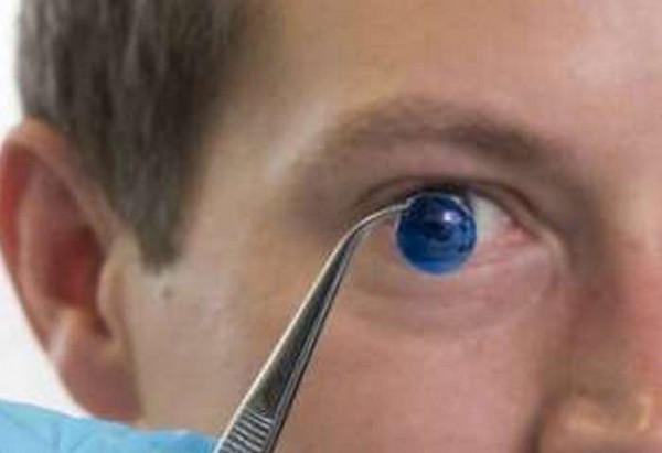 È stata creata una cornea umana con un inchiostro stampato in 3D