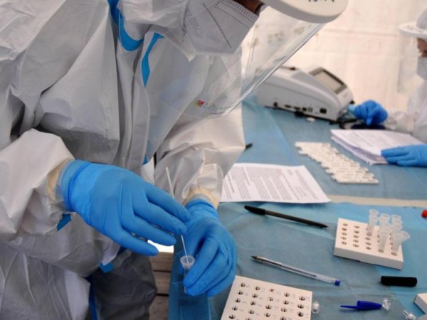 Coronavirus in in Italia 5.923 nuovi casi e 23 morti, positività al 3,4%: bollettino del 22 agosto