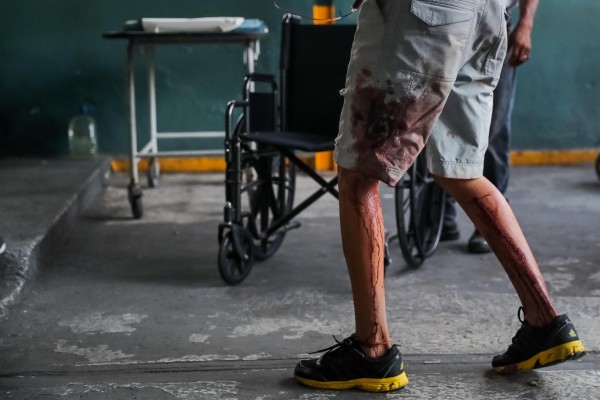 Cuatro jóvenes dos son adolescentes  fueron asesinados en dos días de protestas en Venezuela