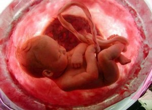 La modifica di un embrione umano &#039;difettoso&#039; è un trionfo storico per la medicina