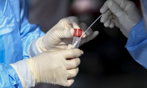 Coronavirus in Italia 5.188 casi e 63 morti per Covid. Il tasso di positività scende allo 0,7%:bollettino del 3 novembre