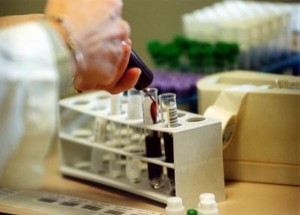 Primi passi per test sangue che scopre i tumori