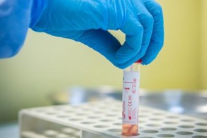 Coronavirus in Italia, 252 nuovi casi e 5 morti