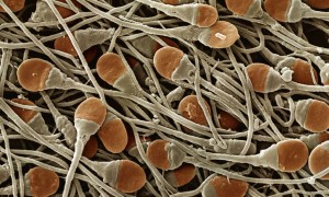 Il nuovo anticoncezionale maschile che blocca lo sperma per 24 mesi