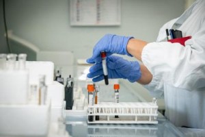 Coronavirus in Italia,  calano i contagi, aumentano morti, 13 morti e 169 nuovi casi