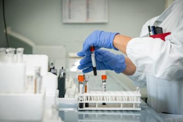 Coronavirus in Italia,  calano i contagi, aumentano morti, 13 morti e 169 nuovi casi