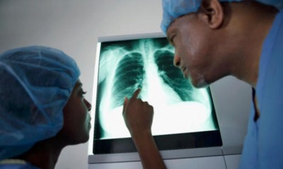Tumore del polmone: ogni giorno in Italia 110 nuove diagnosi