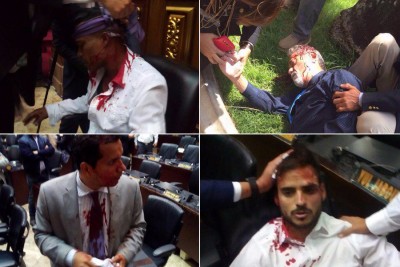 Grupos chavistas irrumpen en el Parlamento venezolano y hieren a diputados