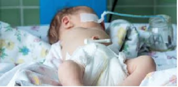 Bretagna: il mistero dei bambini &quot;sans bras&quot;. 25 casi dal 2000 ed il 2017
