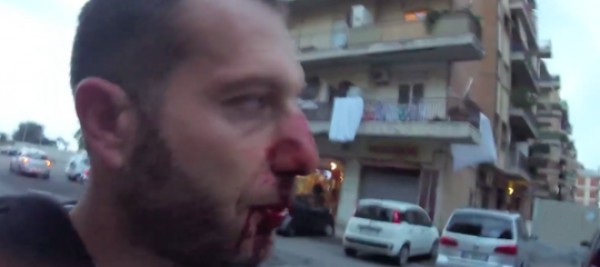 &quot;Ipocrita arrestare Spada per avermi rotto il naso&quot;