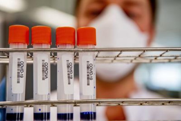 Coronavirus, in Italia altri 85 morti e oltre 500 nuovi casi, 33.774 morti in totale.