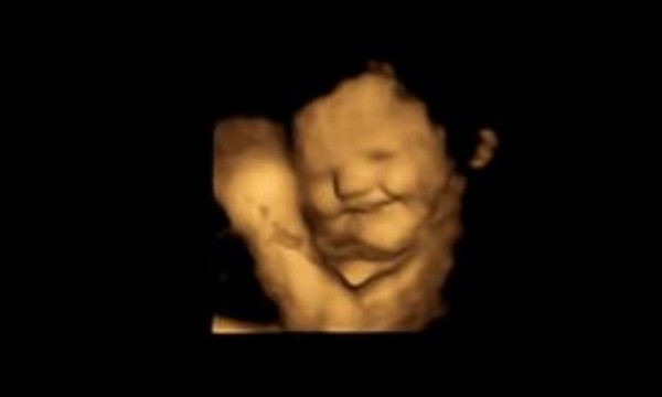 Nella pancia della mamma il feto reagisce (a volte male) ai sapori dei cibi