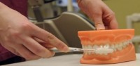 Dentisti estraggono oltre 500 denti dalla bocca di un bambino di 7 anni. E il video dell&#039;intervento diventa virale