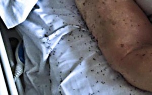 Napoli, choc in ospedale: paziente a letto tra le formiche. Beatrice Lorenzin invia task force