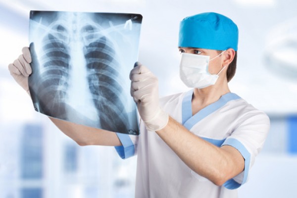 Tumore del polmone: “aumentano i pazienti che beneficiano dell’immunoterapia Pembrolizumab&quot;