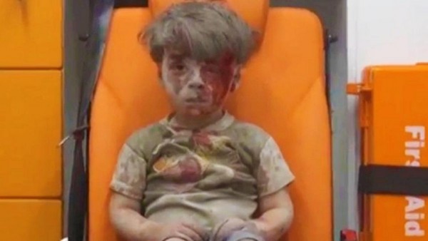 L&#039;orrore della guerra in Siria nel volto del piccolo Omran Onu, da un mese nessun convoglio umanitario nelle zone assediate