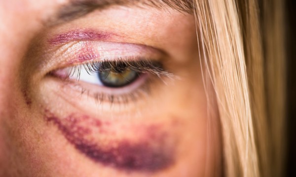 Violenza sulla donne, un&#039;emergenza che resta difficile da eliminare 