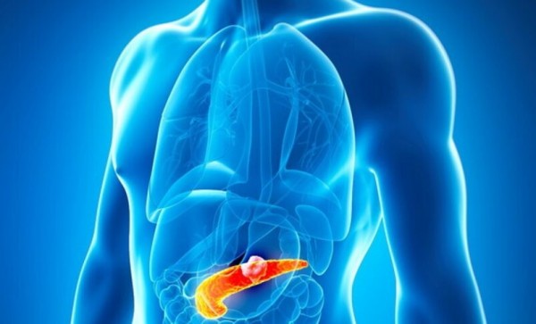 cancro tumore pancreas 