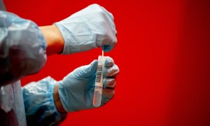 Coronavirus in Italia  39.963 contagi e 173 morti: bollettino 5 marzo