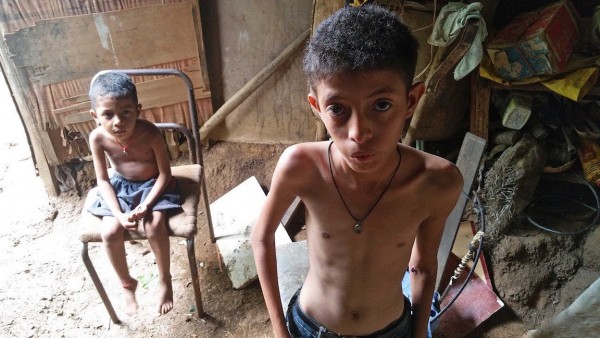 Cáritas: Desnutrición infantil aumenta en Venezuela