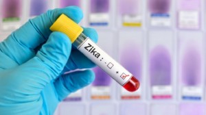 Allarme Zika, in Spagna nasce bimbo con microcefalia virale
