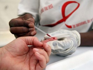 Nelle sedi della Lila, test rapidi e gratuiti per l’Hiv