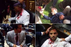 Venezuela: assalto chavista in parlamento, feriti 7 deputati. Fabio Porta (PD) "una delle pagine pi&ugrave; drammatiche della sua storia!"