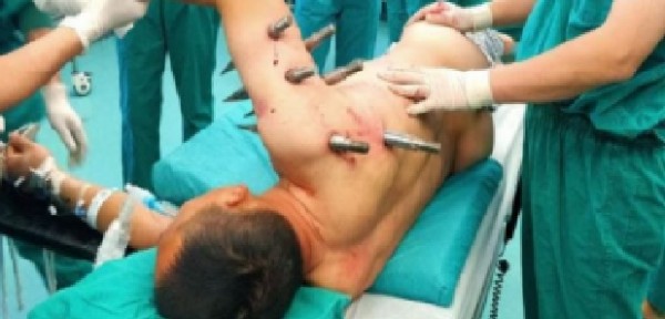 Robot Killer: una macchina della fabbrica infilza l'operaio con punte d'acciaio a causa di un guasto