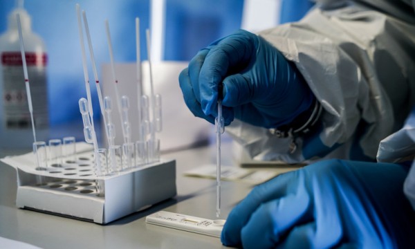 Coronavirus in Italia  36.429 casi Covid e 214 morti. Tasso di positivit&agrave; all'8,8%: bollettino 02 marzo