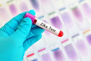 Zika pu&ograve; danneggiare anche il cervello degli adulti